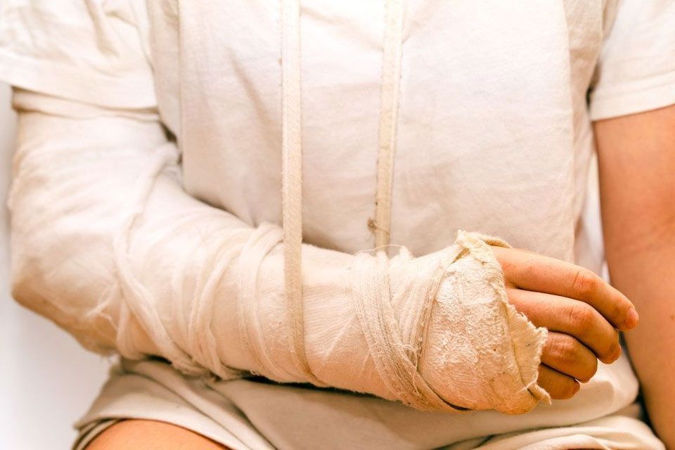 victim with broken arm